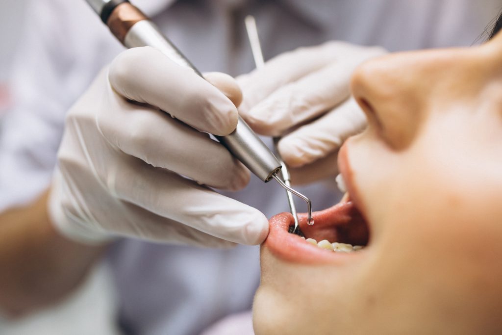 patient au dentiste, gros plan sur la bouche