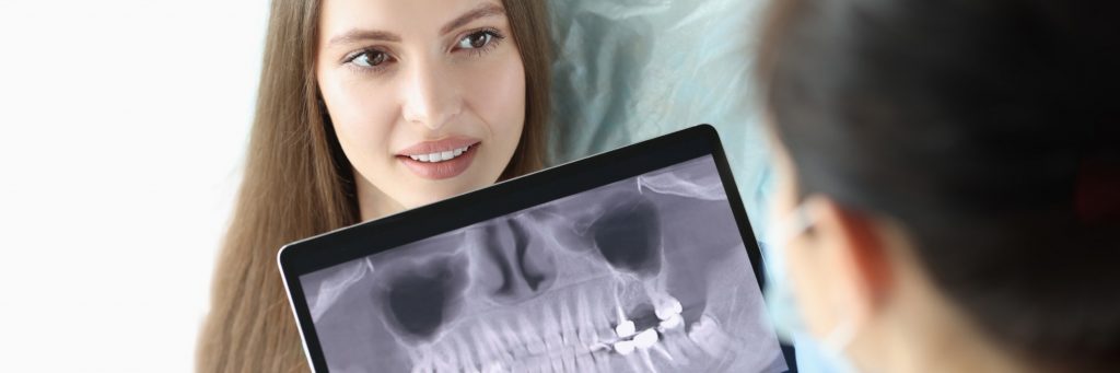 Implant or Removable Prosthesis