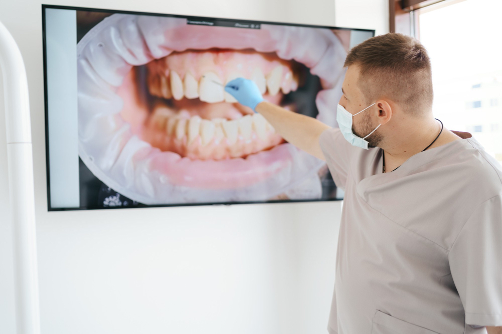 Retrouver votre sourire avec la facette dentaire radiographie des dents