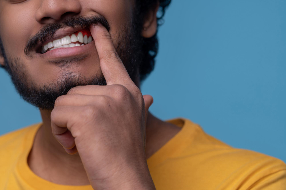 Man making himself smile with finger